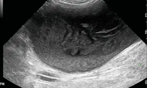 Badanie USG pęcherza moczowego psa z widocznymi zmianami.