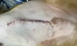 Szwy po kastracji kota. Rana jest zaszyta metalowymi klamerkami, widoczne są drobne zaczerwienienia.