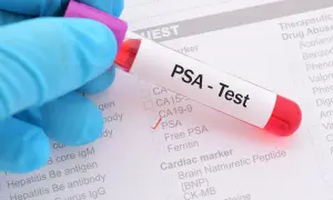 Probówka z krwią do testu PSA na tle formularza medycznego z zaznaczoną opcją PSA.